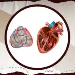 درجات ارتجاع الصمام الثلاثي الشرفات