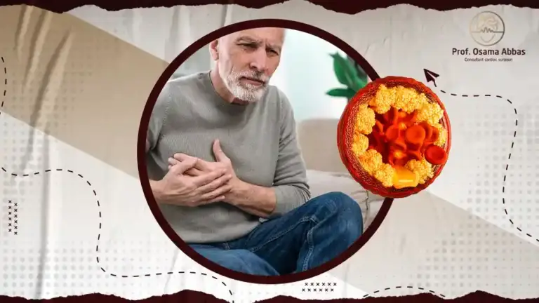 ما هو علاج الدهون الثلاثية والكلسترول وتصلب الشرايين خلال اسبوعين؟
