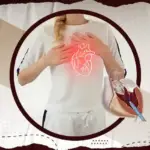 علاج ضيق الصمام الميترالي