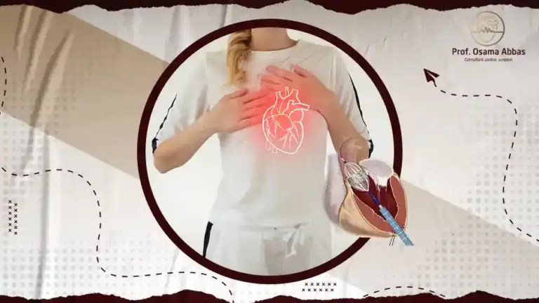 ما هو علاج ضيق الصمام الميترالي؟ – ( توصل معنا الأن )