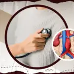 اعراض تمدد الشريان الاورطي (1)