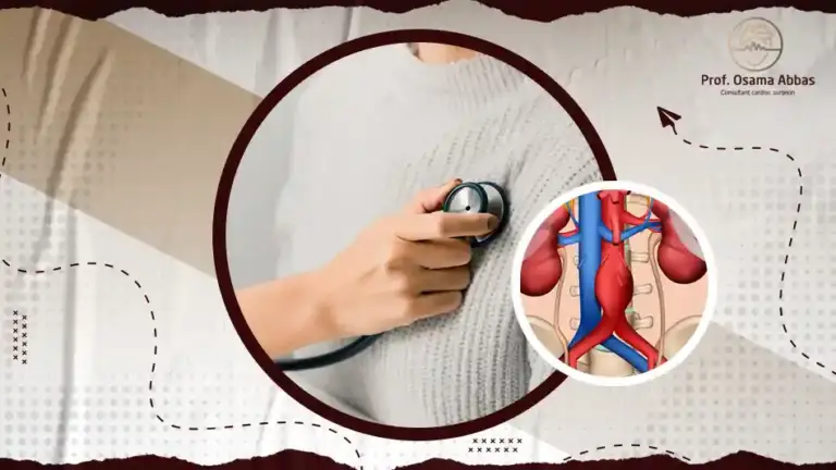 ما هي اعراض تمدد الشريان الاورطي؟
