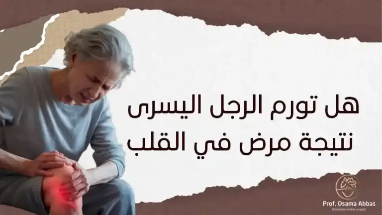 هل تورم الرجل اليسرى نتيجة مرض في القلب؟