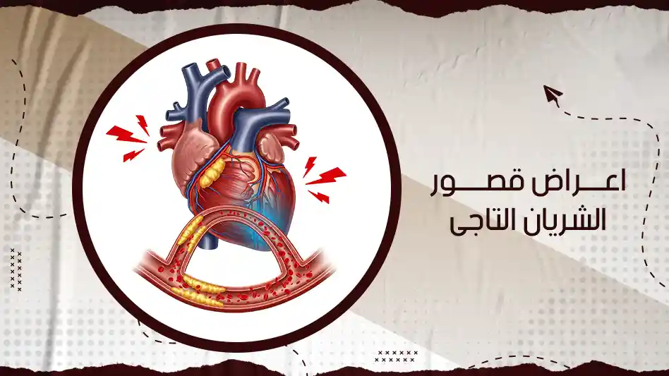 اعراض قصور الشريان التاجى