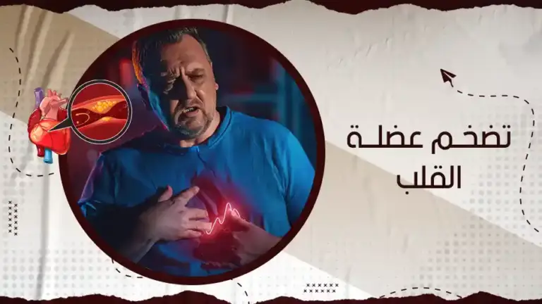 ما هو تضخم عضلة القلب؟