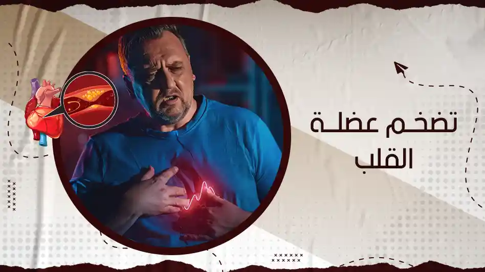 تضخم عضلة القلب