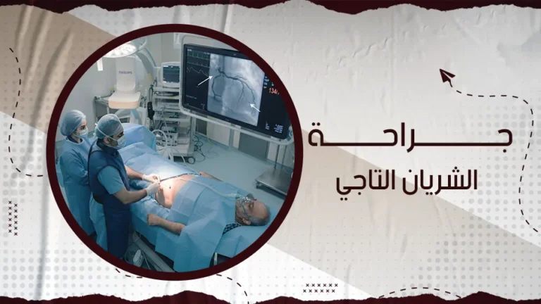 ما هي جراحة الشريان التاجي وكيف تتم؟