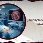 عملية تغيير الصمام الميترالى بالمنظار