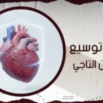 عملية توسيع الشريان التاجي