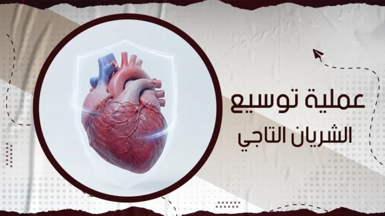 ما هي عملية توسيع الشريان التاجي وكيف تتم؟