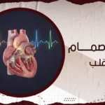 عملية صمام القلب