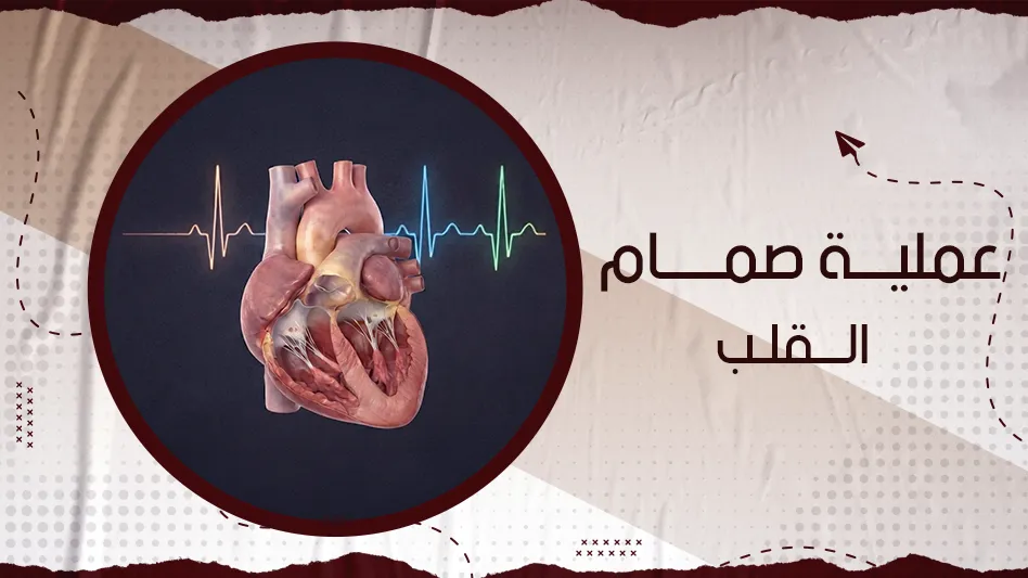 عملية صمام القلب
